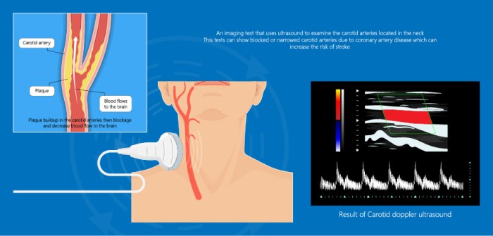 Liver imaging with vascular flow cpt code